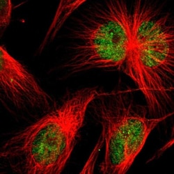 SP2 Antibody, Novus Biologicals 25 &mu;L; Unlabeled:Antibodies, Polyclonal